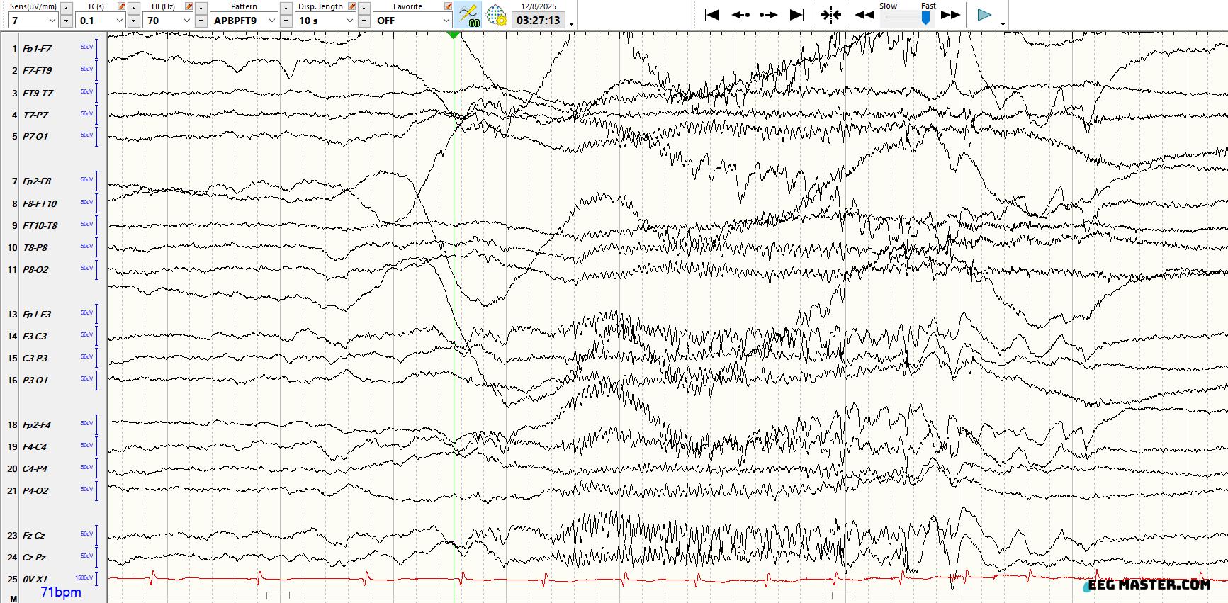 EEG Master- learn EEG