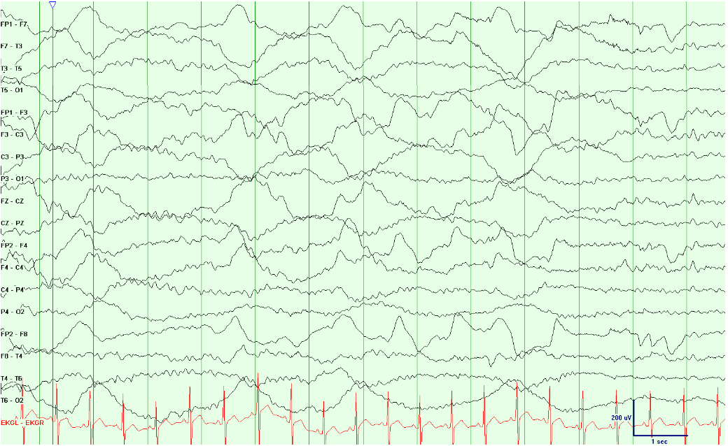 Galvanic Skin Responses