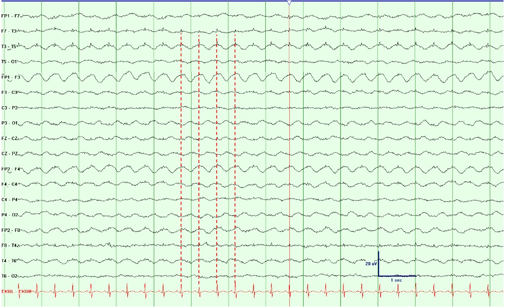 Cardioballistogram