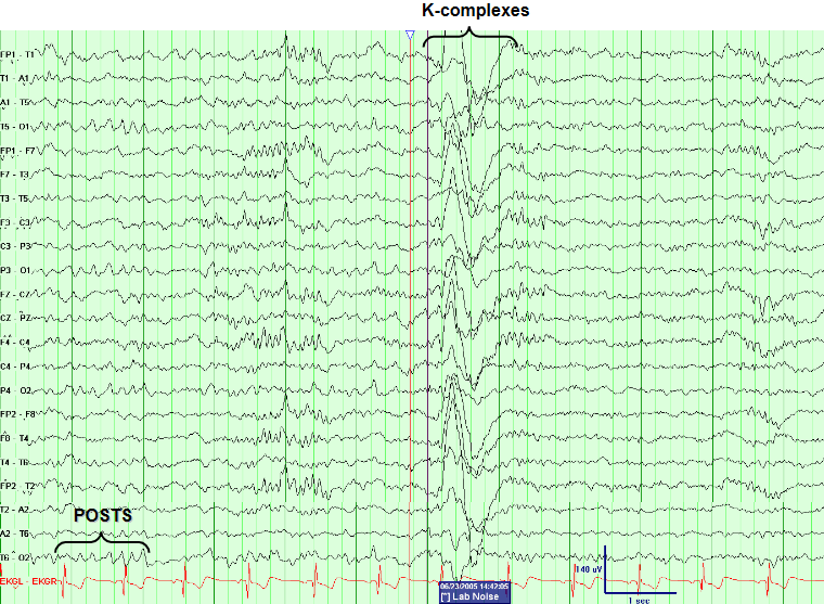 K-complexes during N2 Sleep