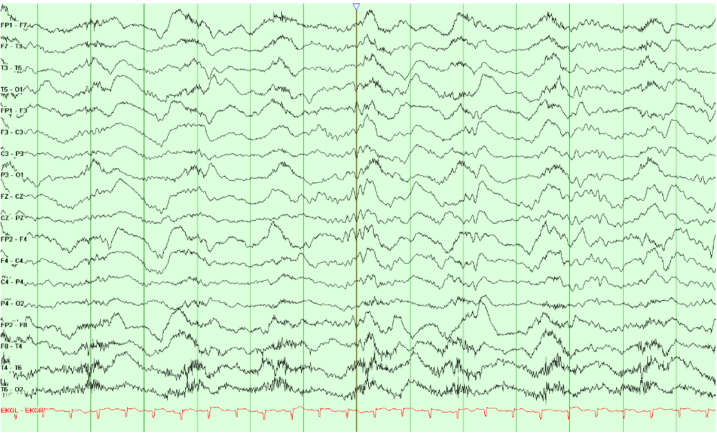 Dominant frequency