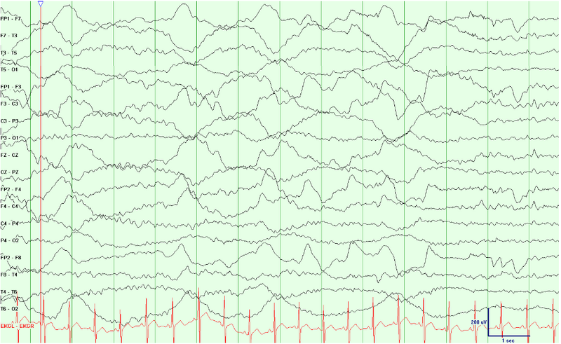 File:Galvanic Skin Responses.png