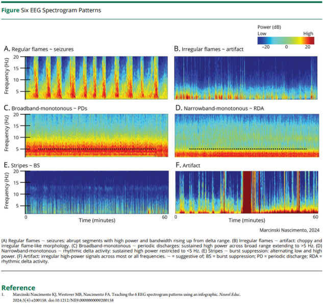 File:Six EEG Spectrogram Patterns.png