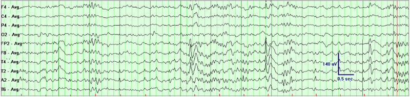 File:Waves009.png