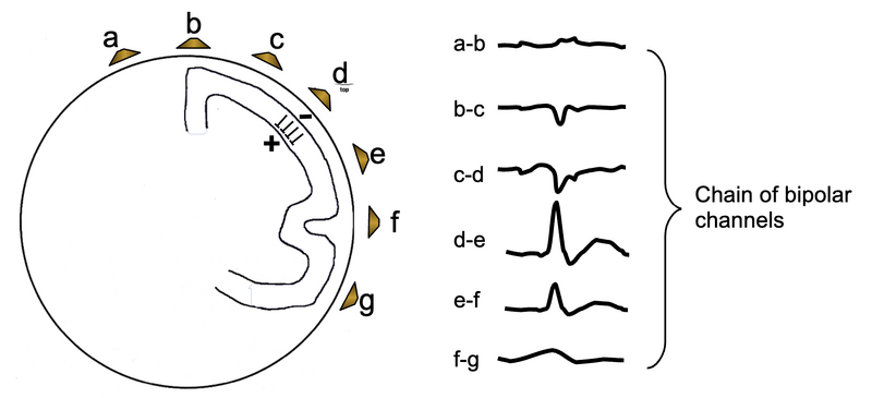 File:Chain of bipolar channels.png