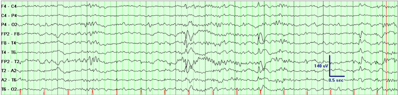 File:Waves008.png
