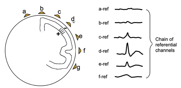 Chain of referential channels