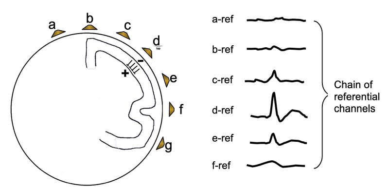 File:Chain of referential channels.png