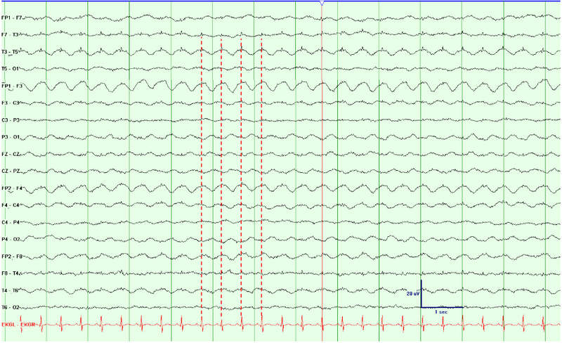 File:Cardioballistogram.png
