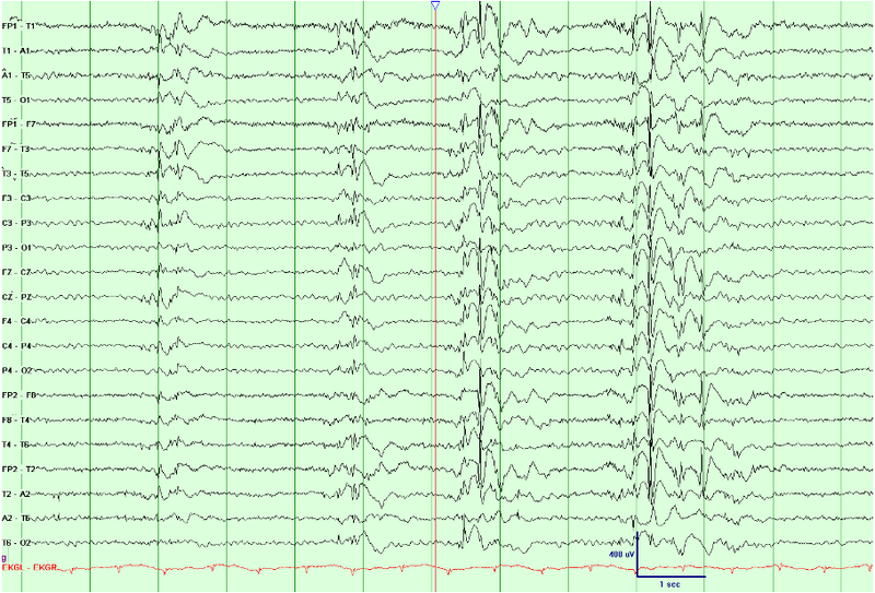 File:Waves004.png
