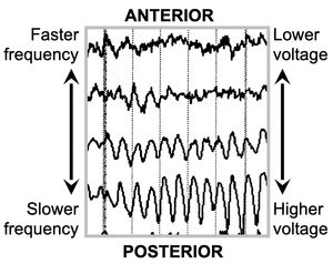anterior-posterior voltage and frequency gradients