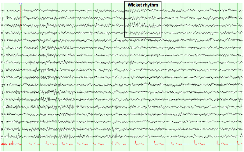 File:Wicket rhythm.png