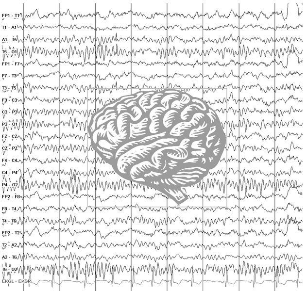 File:Image001 introduction-to-eeg.png