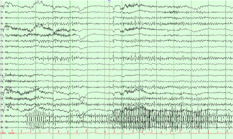File:Physiologic Movements.png