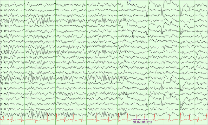 File:8 year old EEG.png