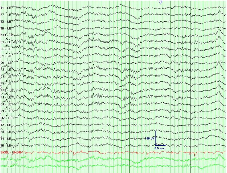 File:Dominant Frequency001.png