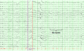 Thumbnail for version as of 11:27, 27 March 2026