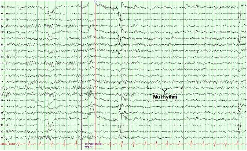Mu rhythm