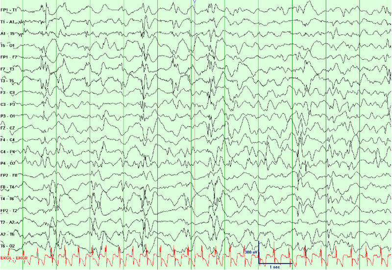 File:Waves006.png