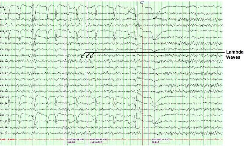 File:Lambda waves.png