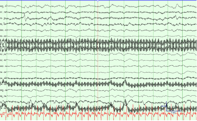 File:Waves001.png