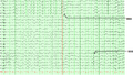 Thumbnail for version as of 11:37, 27 March 2026
