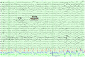 Thumbnail for version as of 09:32, 27 March 2026