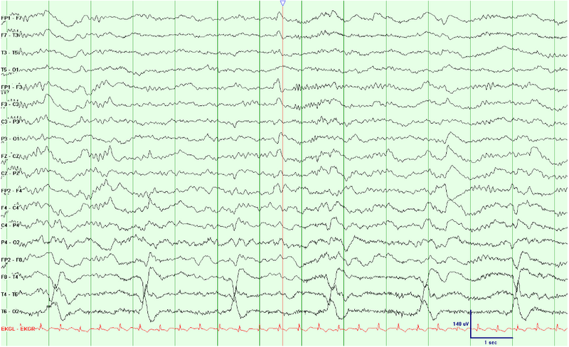 File:Waves002.png