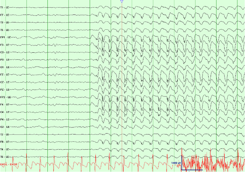File:Waves003.png