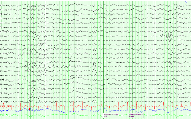 File:Waves007.png