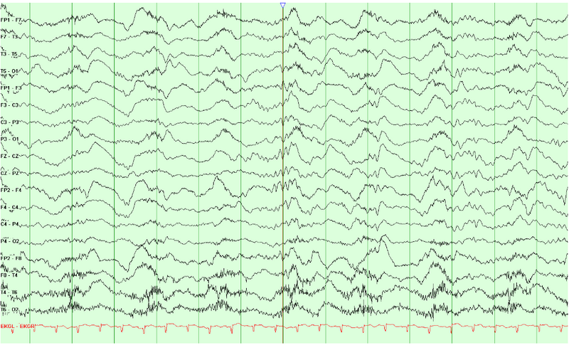 File:Dominant frequency002.png