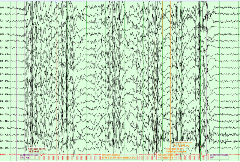 File:Waves005.png